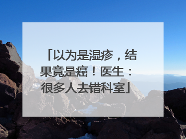 以为是湿疹，结果竟是癌！医生：很多人去错科室